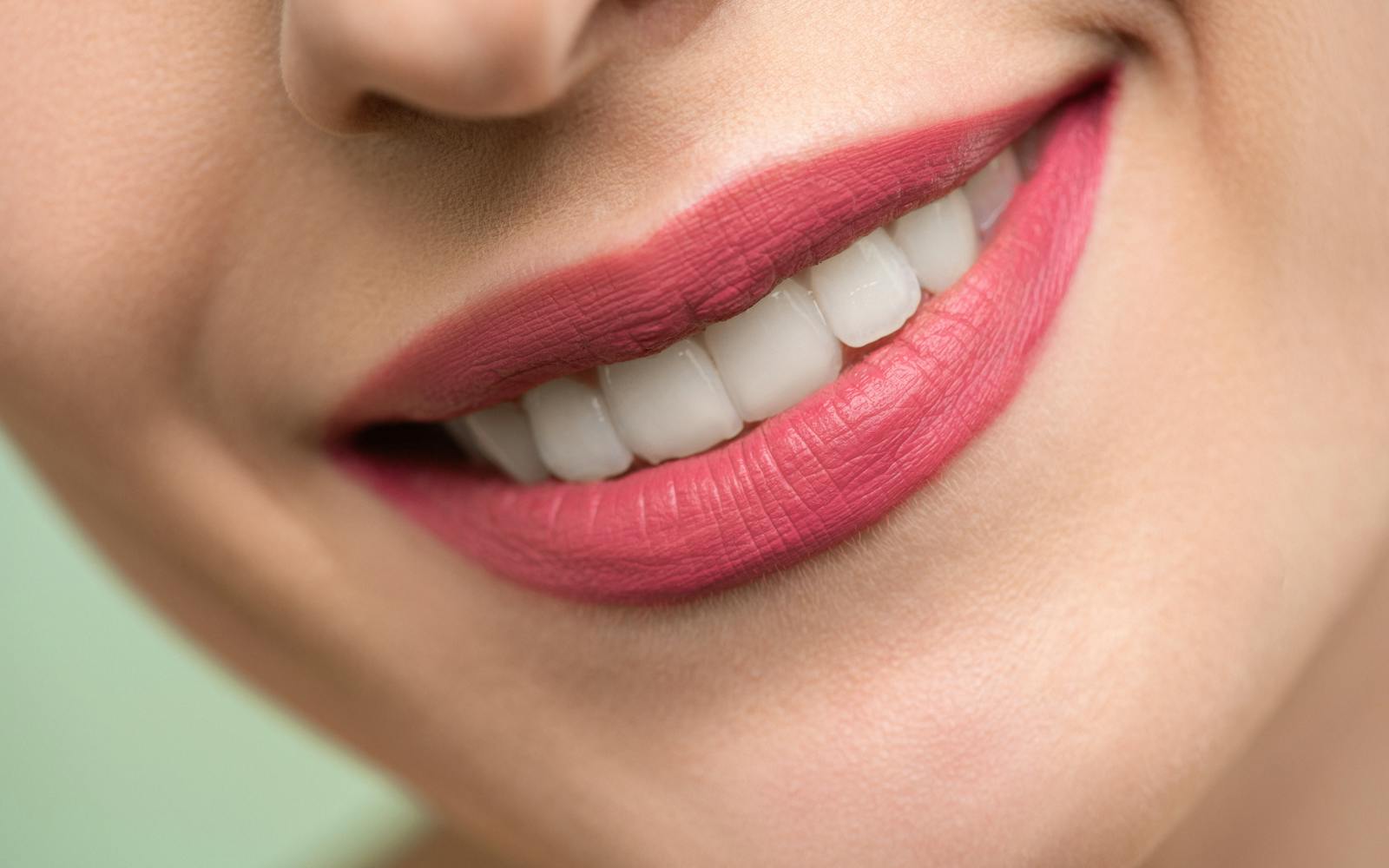 Después: Antes y después de colocación de carillas dentales